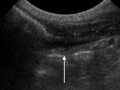 Ultrasound-annotated