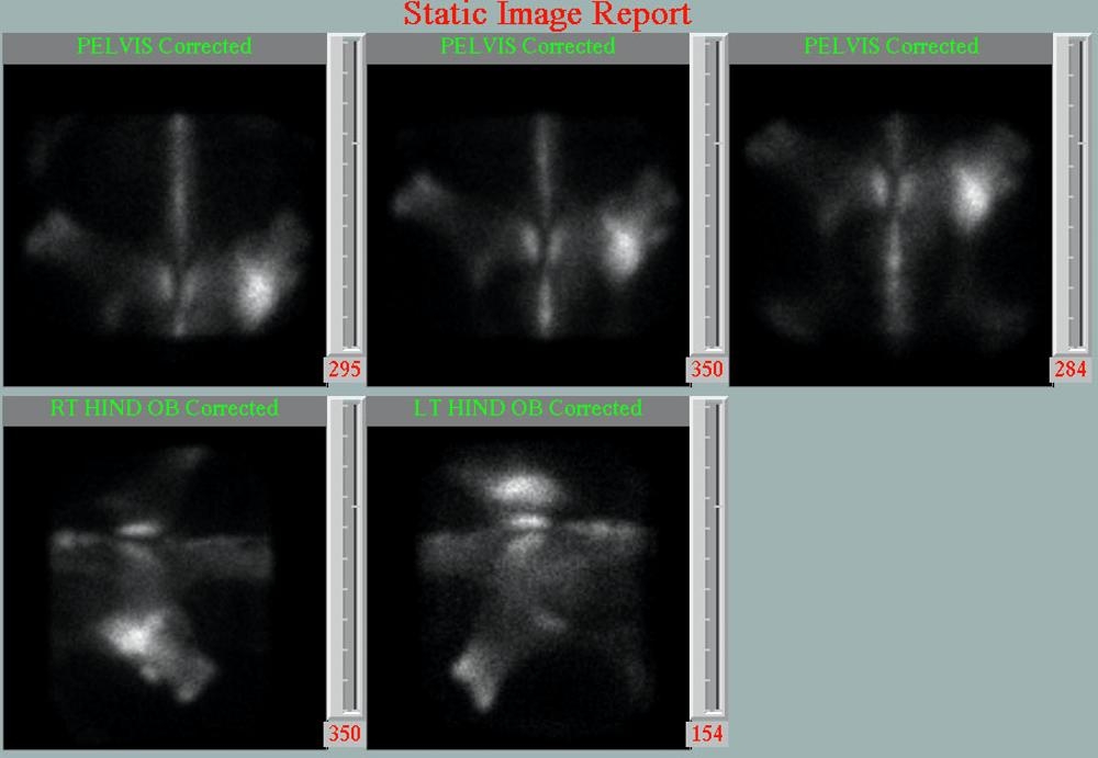 Static Image Report