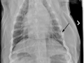 VD Thorax-annotated
