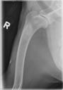 Case of the day