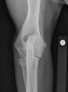 cod120408 Elbow