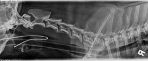 lateral spine