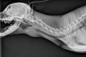 lateral neck