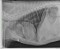 lateral_thorax
