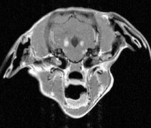 transverse brain