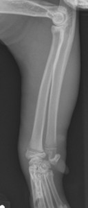lateral forelimb