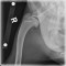 20100805 lateral humerus