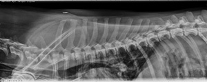 lateral spine