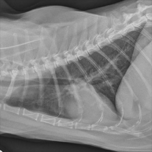 lateral thorax