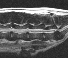 sagittal spine