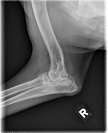lateral elbow