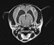 brain