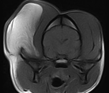 transverse skull MR