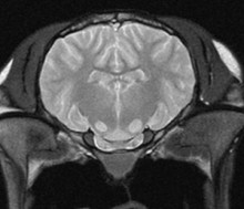 T2_brain