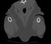 ct_forelimbs