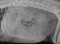 lateral_abdomen