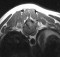 transverse_spine