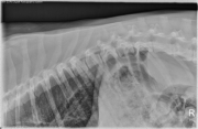 R LAT Thorax