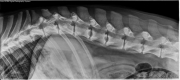 R LAT Spine