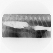 EsophaGRAM