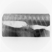 EsophaGRAM