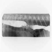 EsophaGRAM