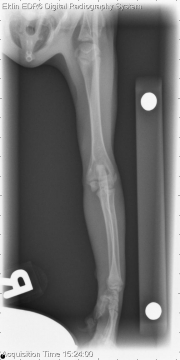 R LAT Elbow