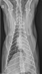 DV Thorax