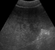 Ultrasound 1