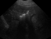 Ultrasound 2