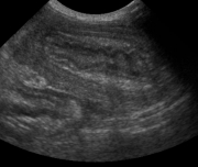 Ultrasound 1