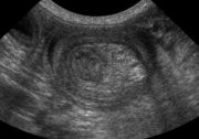 Ultrasound 2