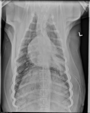 DV Thorax