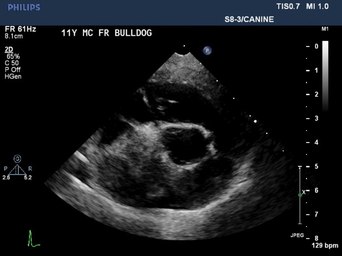 echocardiography