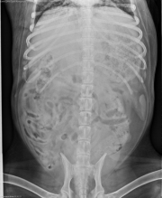 VD Abdomen