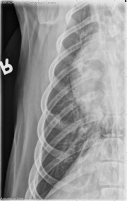 DV Thorax