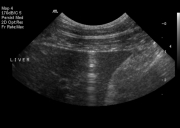 ultrasound1