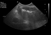 ultrasound3