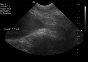 Ultrasound 1