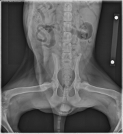 VD Pelvis