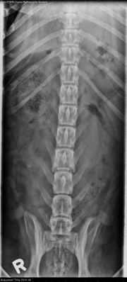 VD Spine