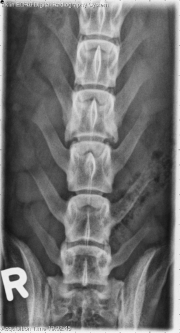 VD Spine