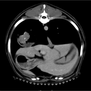 CT Soft tissue window