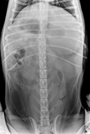 VD Abdomen