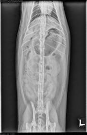 VD Abdomen