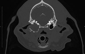 transverse skull