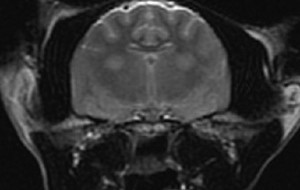 MRI brain