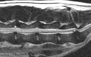 sagittal spine