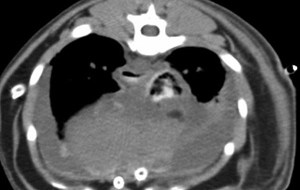 transverse thorax