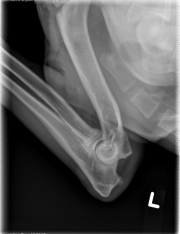 L LAT Elbow